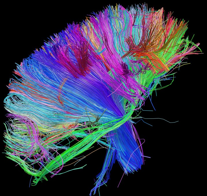 White matter fiber architecture of the brain. Measured from diffusion spectral imaging (DSI).